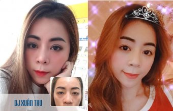 Nhờ cắt mí mắt, nữ DJ cá tính “lột xác” thành quý cô hoàn hảo