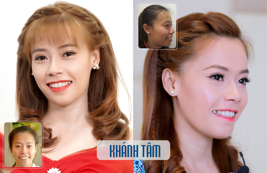 HAM-06