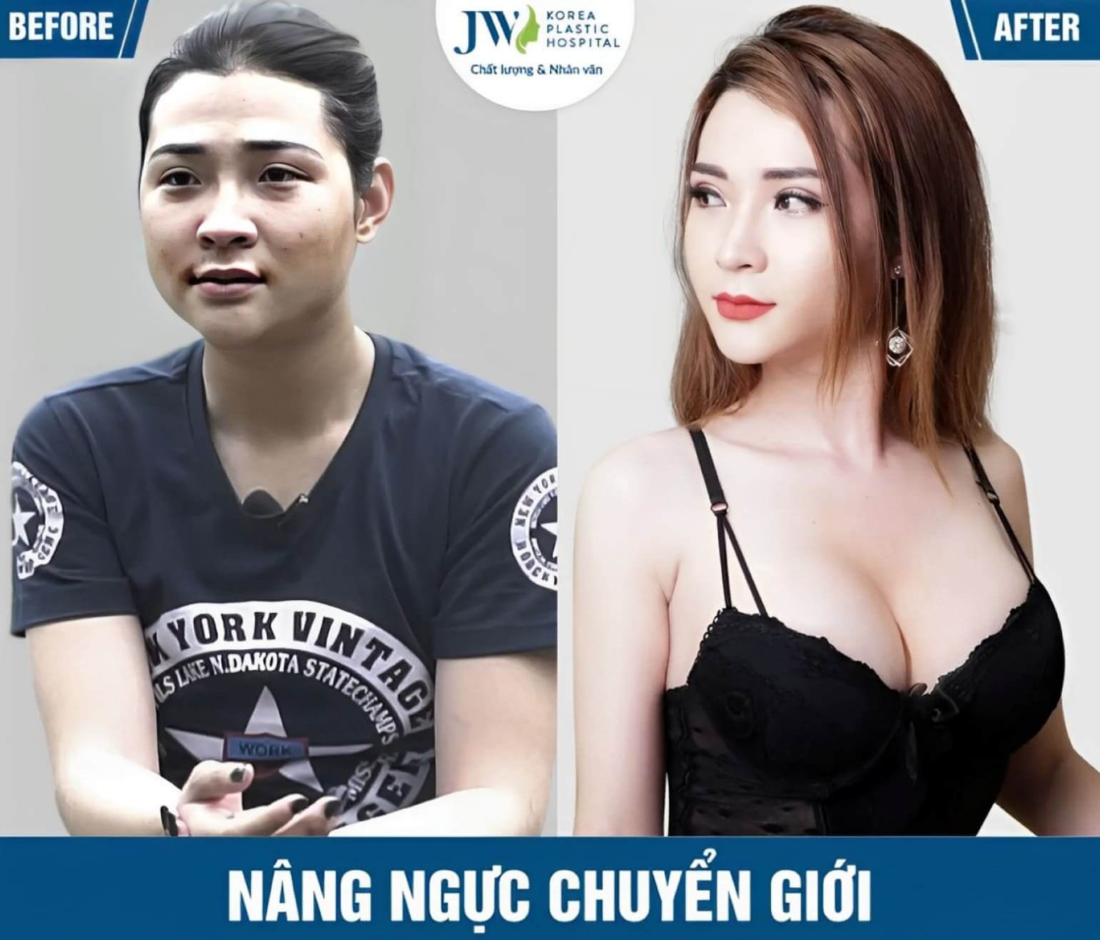 nang nguc chuyen gioi