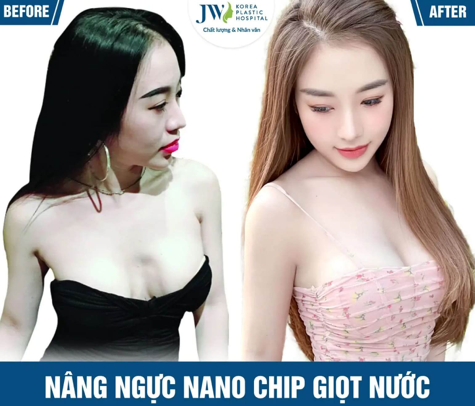 nang nguc nano chip