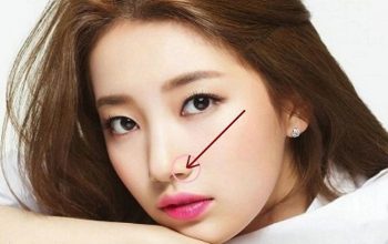 Cắt cánh mũi có phá lộc không? 4 dáng mũi nhiều người ngại thay đổi