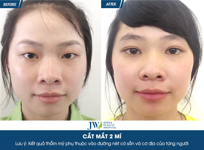 cat-mat-hai-mi-3
