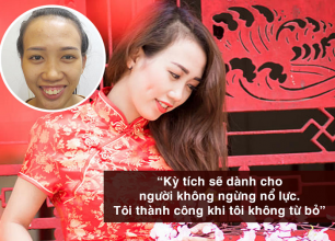 Cô gái xấu xí Ninh Thuận hóa hotgirl nhờ phẫu thuật hàm hô