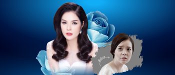 Trẻ hoá da bằng tế bào gốc MULTI ᐩ – Chìa khoá của vẻ đẹp vĩnh cửu