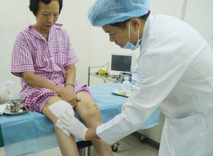 Cụ bà 70 tuổi “chiến thắng” bệnh thoái hoá khớp gối nhờ tiêm tế bào gốc Multi ᐩ