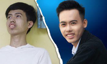 Từ chàng ‘chuột chũi’ đến hotboy nhờ thẩm mỹ