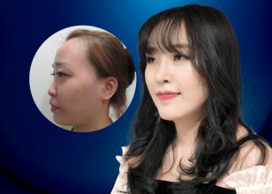 Bí ẩn đằng sau vẻ đẹp như hot girl Hàn của cô gái gốc Việt