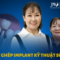 Cấy ghép implant kỹ thuật số 4.0 – Giải pháp phục hình răng bị mất vững chắc trọn đời