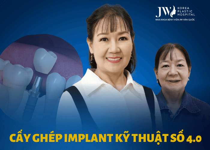 Cấy ghép implant kỹ thuật số 4.0 – Giải pháp phục hình răng bị mất vững chắc trọn đời