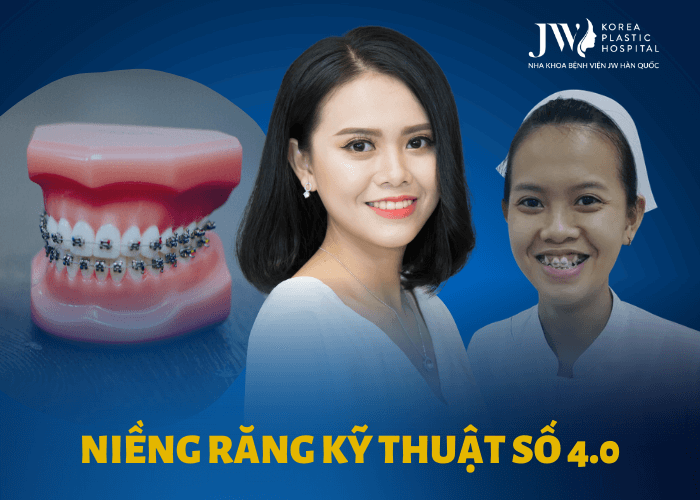 Niềng răng kỹ thuật số 4.0 – Bước tiến mới trong công nghệ chỉnh nha