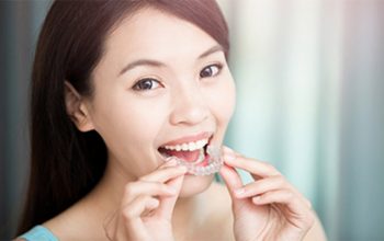 Bảng giá Chỉnh nha – Niềng răng