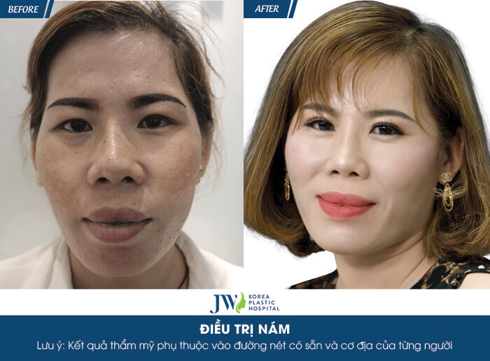 Người phụ nữ An Giang được “tái sinh” sau liệu trình trị nám do dùng kem trộn - hình 6