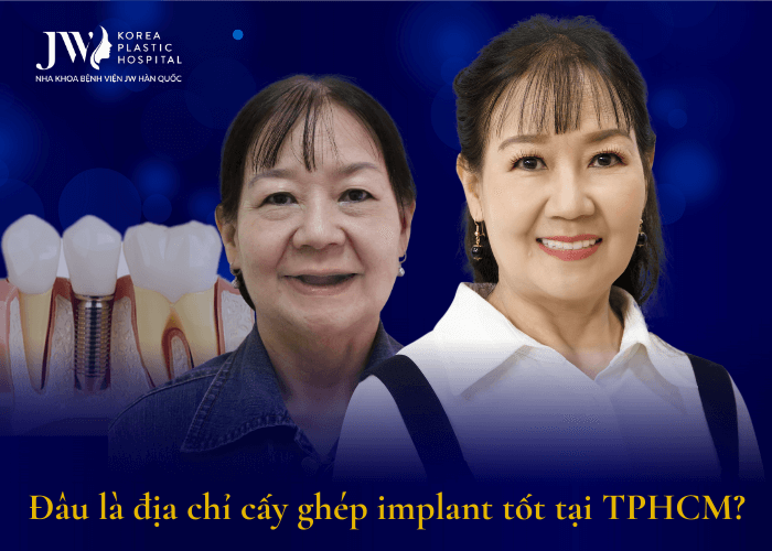 Địa chỉ cấy ghép implant tốt tại TPHCM?
