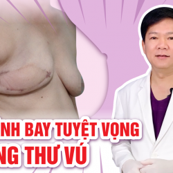 Bệnh viện JW tài trợ 100% cho phụ nữ tái tạo ngực