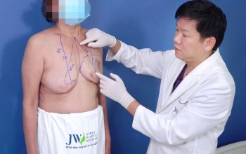 Các phương pháp tái tạo ngực sau điều trị ung thư vú