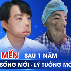 Sau 3 cuộc đại phẫu, anh Mến năm ấy giờ ra sao?