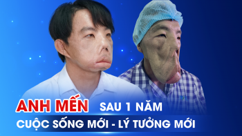 Sau 3 cuộc đại phẫu, anh Mến năm ấy giờ ra sao?