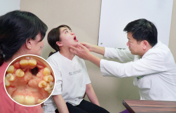 cô gái sứt môi, hở hàm ếch