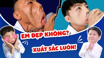 Anh Mến sau 1 năm phẫu thuật thẩm mỹ biến dạng gương mặt giờ ra sao?