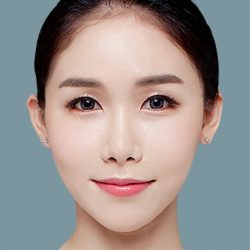 cấy mỡ mặt baby face