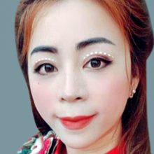 Điều trị sụp mi