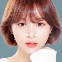 Thu gọn cánh mũi