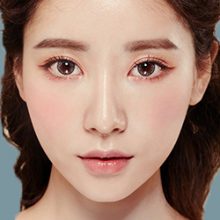 Bảng giá cấy mỡ vùng lõm mi dưới Bệnh viện JW