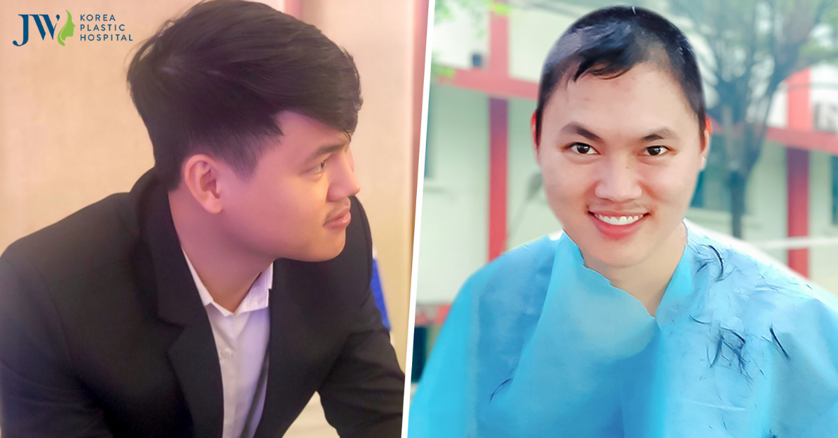 tiêm vaccin covid 19