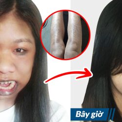 Cuộc sống của cô gái bị gọi là “Khỉ đột” giờ này ra sao?