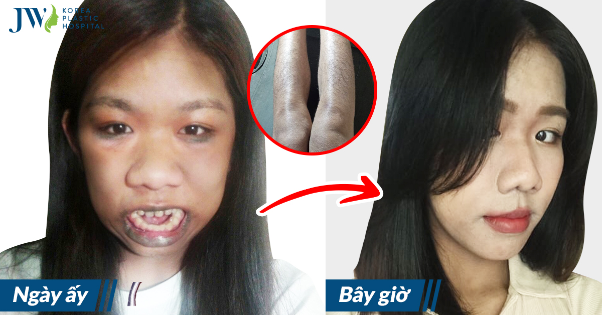 Tường Vân sau 3 năm phẫu thuật thẩm mỹ