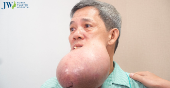 Cuộc đua tìm đường phẫu thuật khẩn cấp cho người đàn ông có khối u khổng lồ