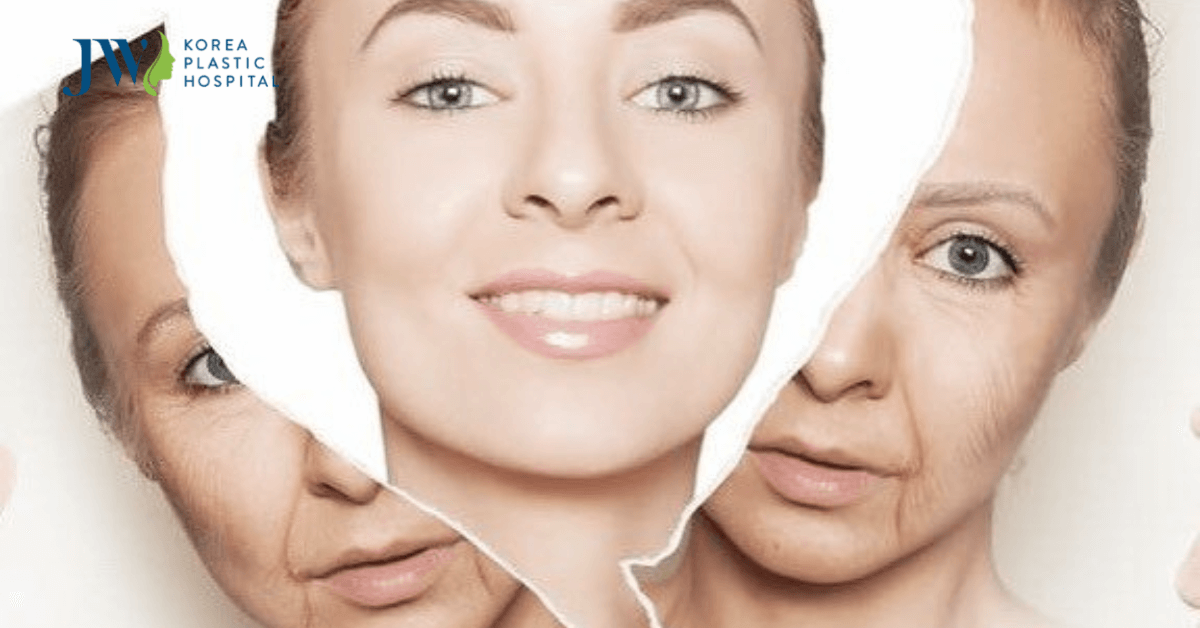 cải lão gương mặt 3m