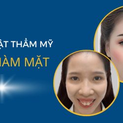 Phẫu thuật thẩm mỹ răng hàm mặt – Đối tượng, ưu nhược điểm