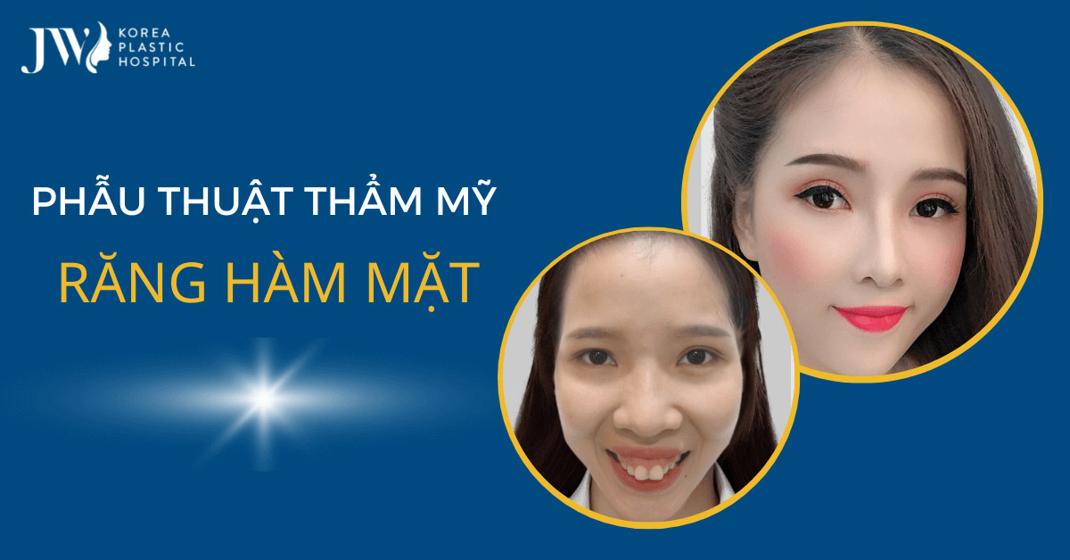 phẫu thuật thẩm mỹ răng hàm mặt chính là chìa khóa