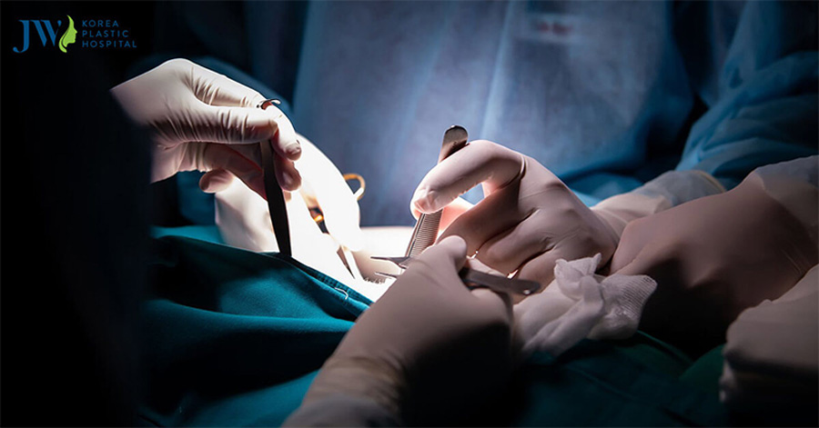 Sự cố y khoa trong phẫu thuật