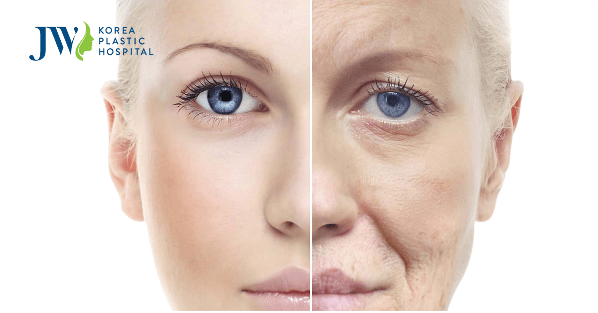 cai lao guong mat 3m