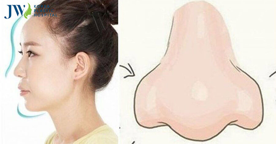 tướng mũi cà chua trong nhân tướng học