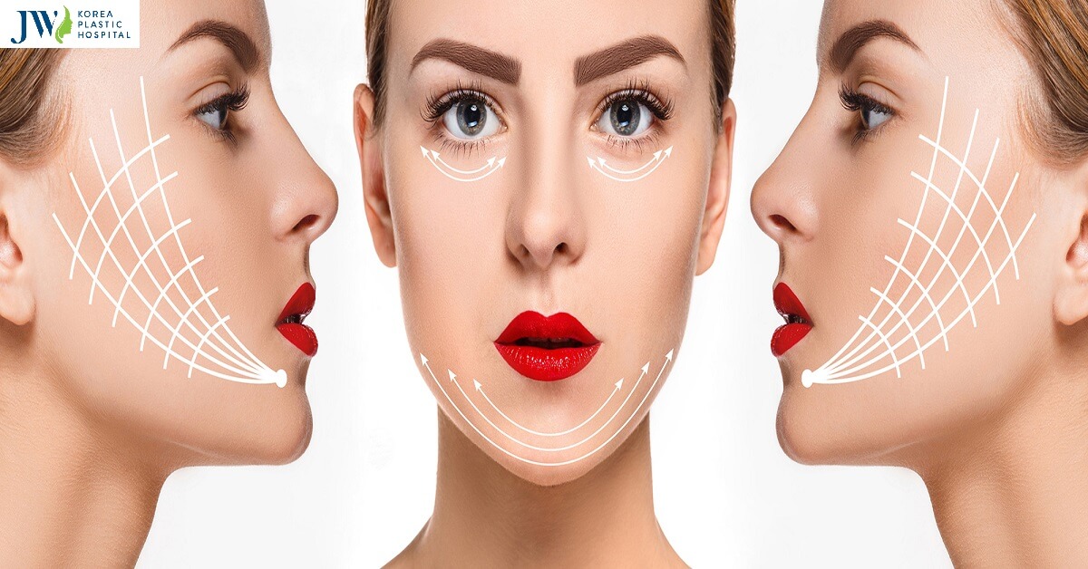 kinh nghiem cang da bang chi