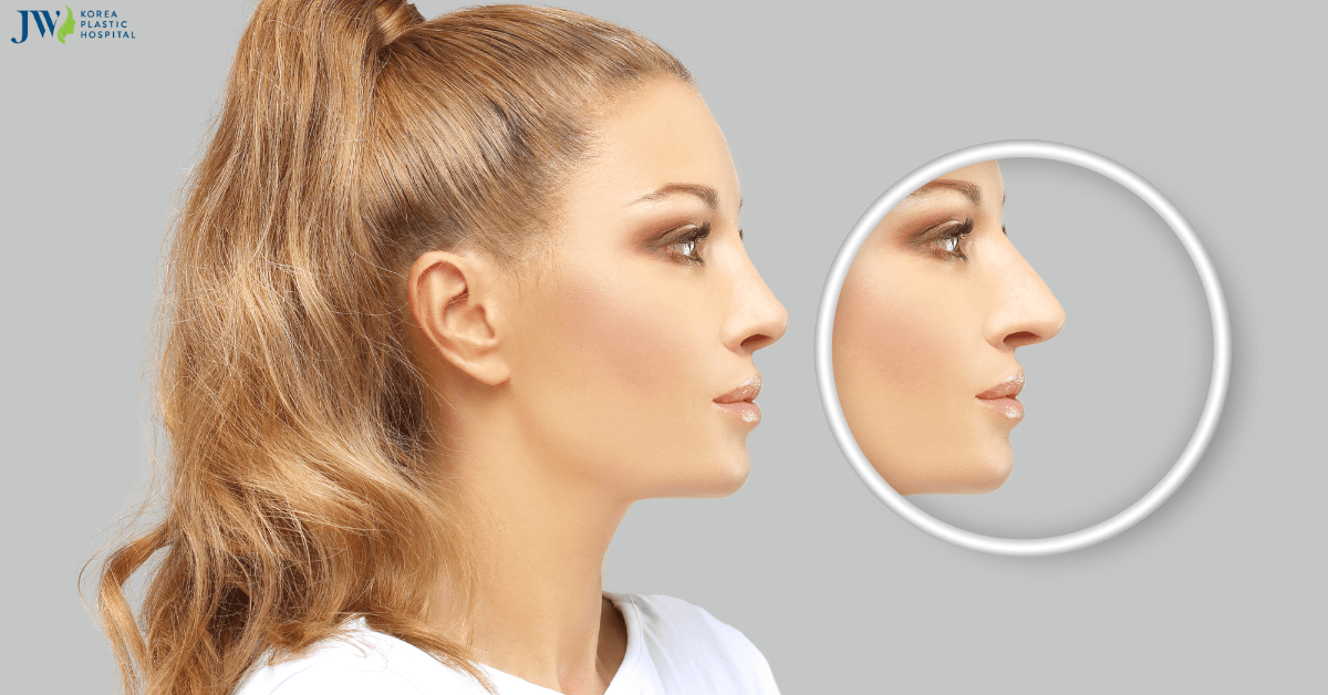 Mũi của chúng ta có cao lên theo thời gian không?