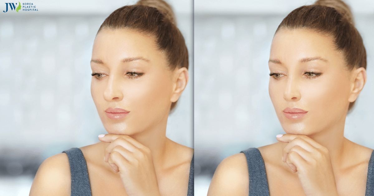 Những cách làm nhỏ mũi có thể bạn chưa biết!_Thumb