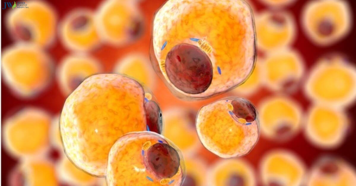 Tế bào gốc mô mỡ là gì và ứng dụng của chúng Thumb