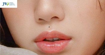 Nốt ruồi nhân trung nữ là có ý nghĩa như thế nào? Tốt hay xấu?