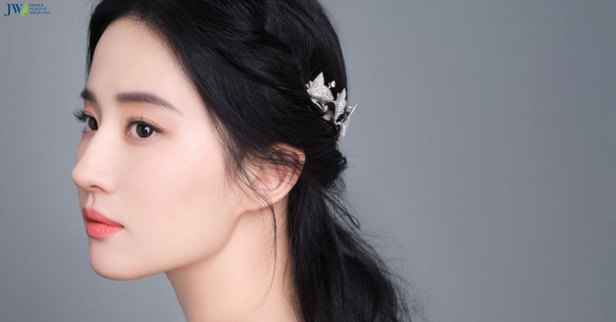 Tất tần tật về cấy chỉ tăng sinh collagen Thumb