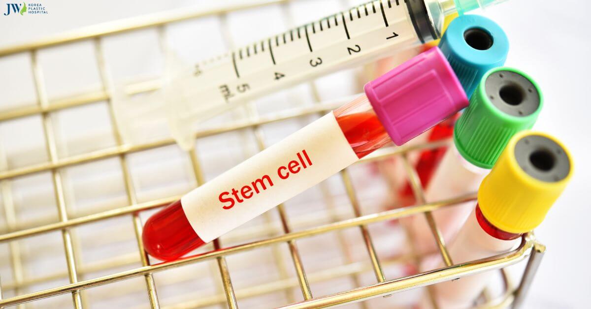Tế bào gốc có thể chữa bệnh gì? Thumb