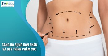 căng da bụng bán phần