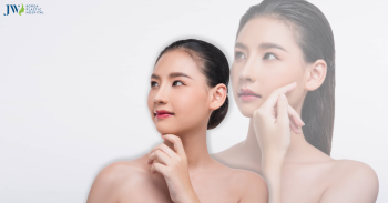Nâng Mũi S-Line: Lựa Chọn Hoàn Hảo Cho Chiếc Mũi Đẹp