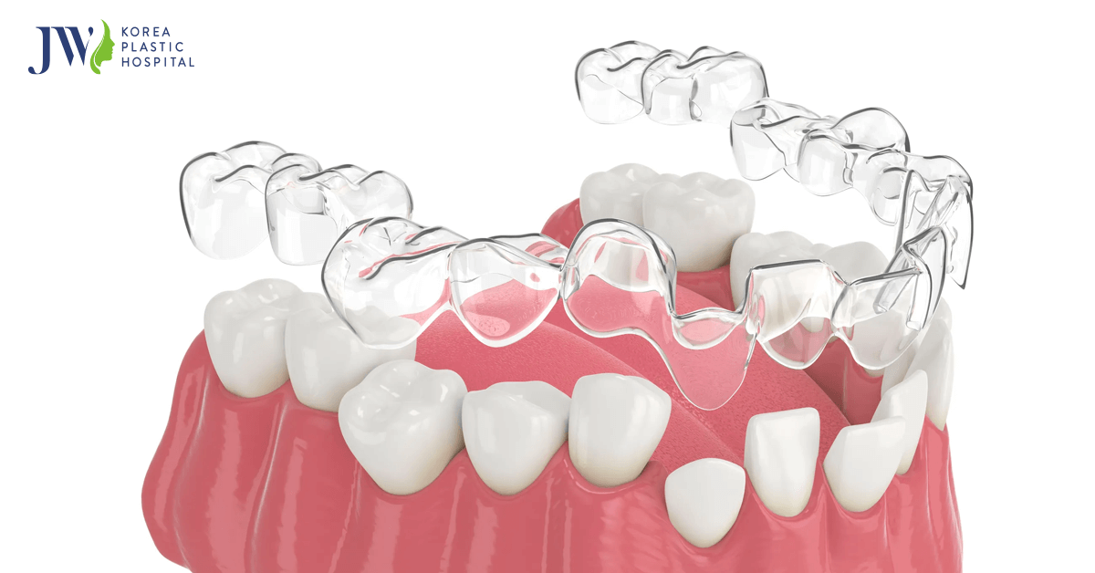 nieng rang trong suot AI