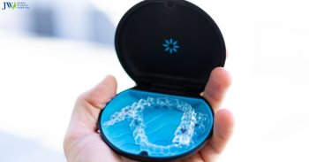 Tại sao bạn nên chọn niềng răng bằng khay trong suốt AI?