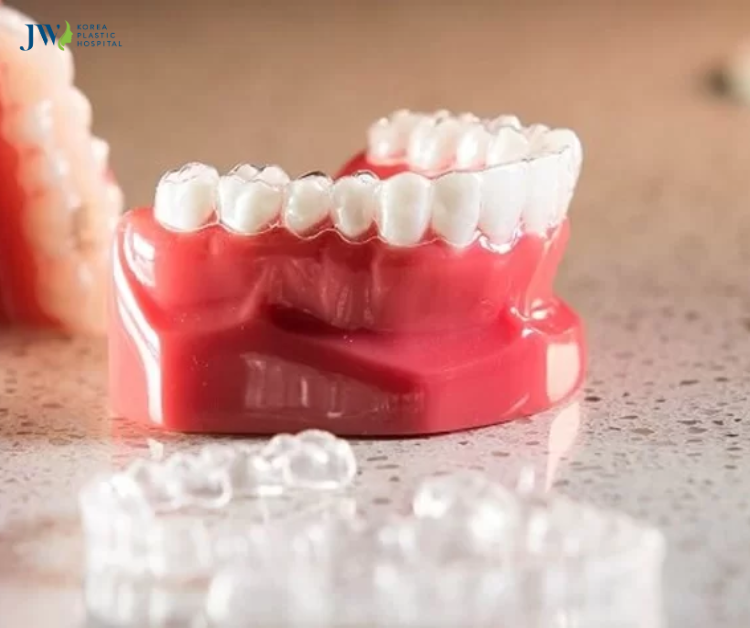 Niềng răng 3D Clear và niềng răng trong suốt AI