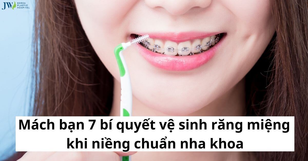 Mách bạn 7 bí quyết vệ sinh răng miệng khi niềng chuẩn nha khoa thumb